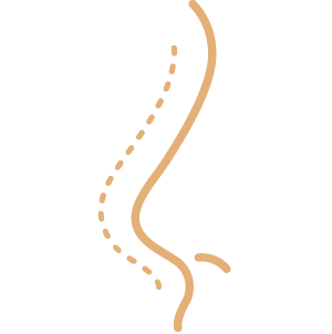 Split Ear Lobe Repair